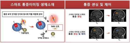 실시간 통증 센싱 및 제어용 생체소재 대표 이미지