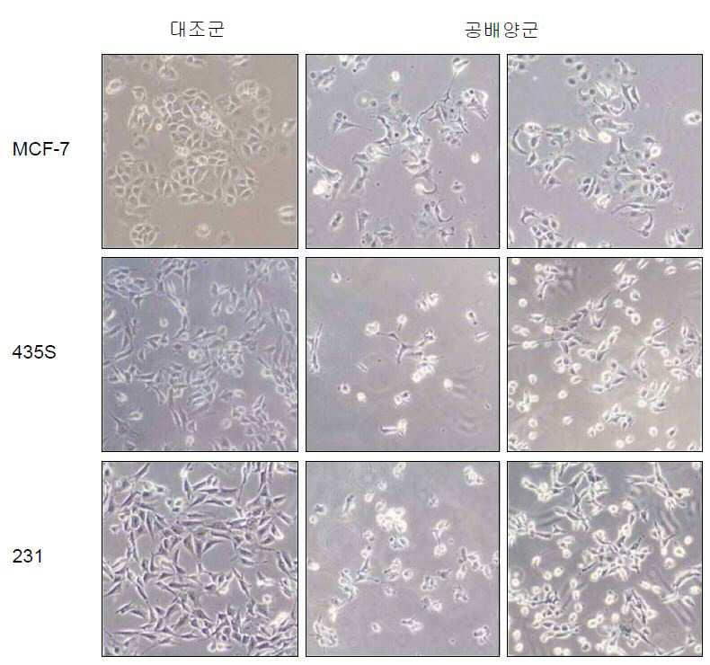 유방암 세포의 배양 방법 및 이를 이용한 유방암 관련 약물 스크리닝 방법 대표 이미지