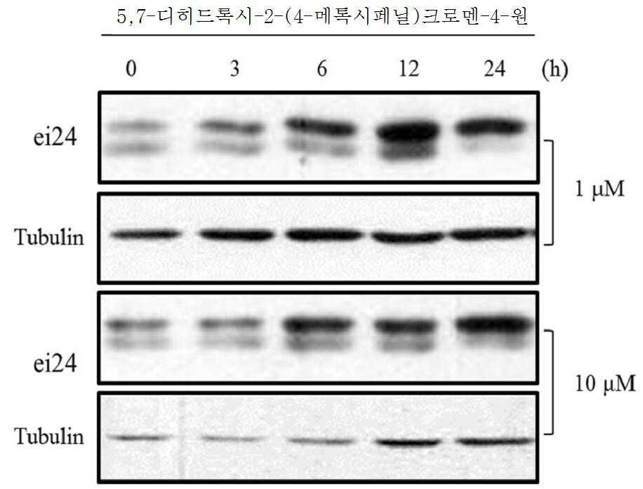 엉겅퀴 추출물을 유효성분으로 포함하는 암의 전이 또는 침윤 억제용 조성물 대표 이미지