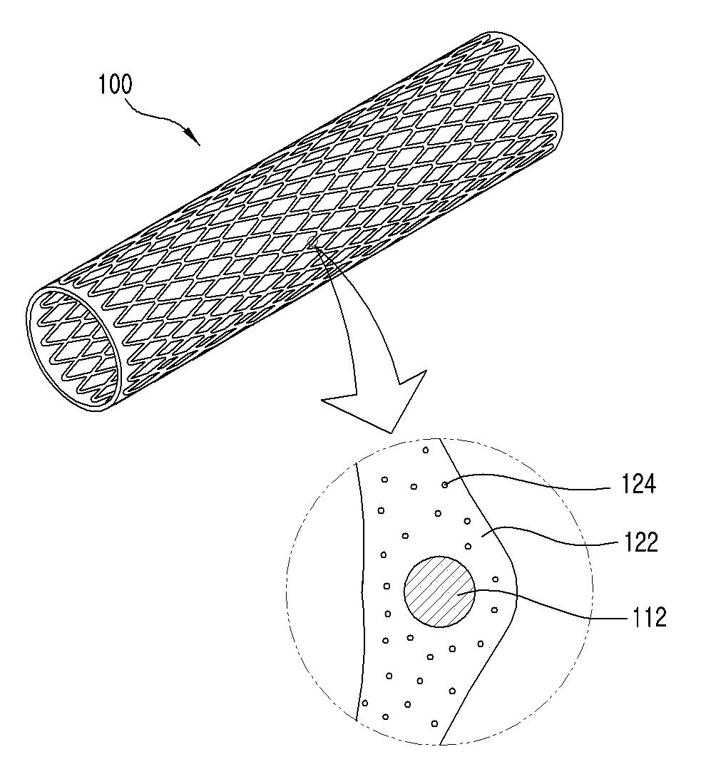 약물이 담지된 생분해성 코팅막을 가지는 혈관용 스텐트 대표 이미지