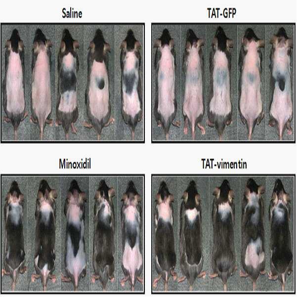 비멘틴을 포함하는 탈모 억제 또는 발모 촉진용 조성물 대표 이미지