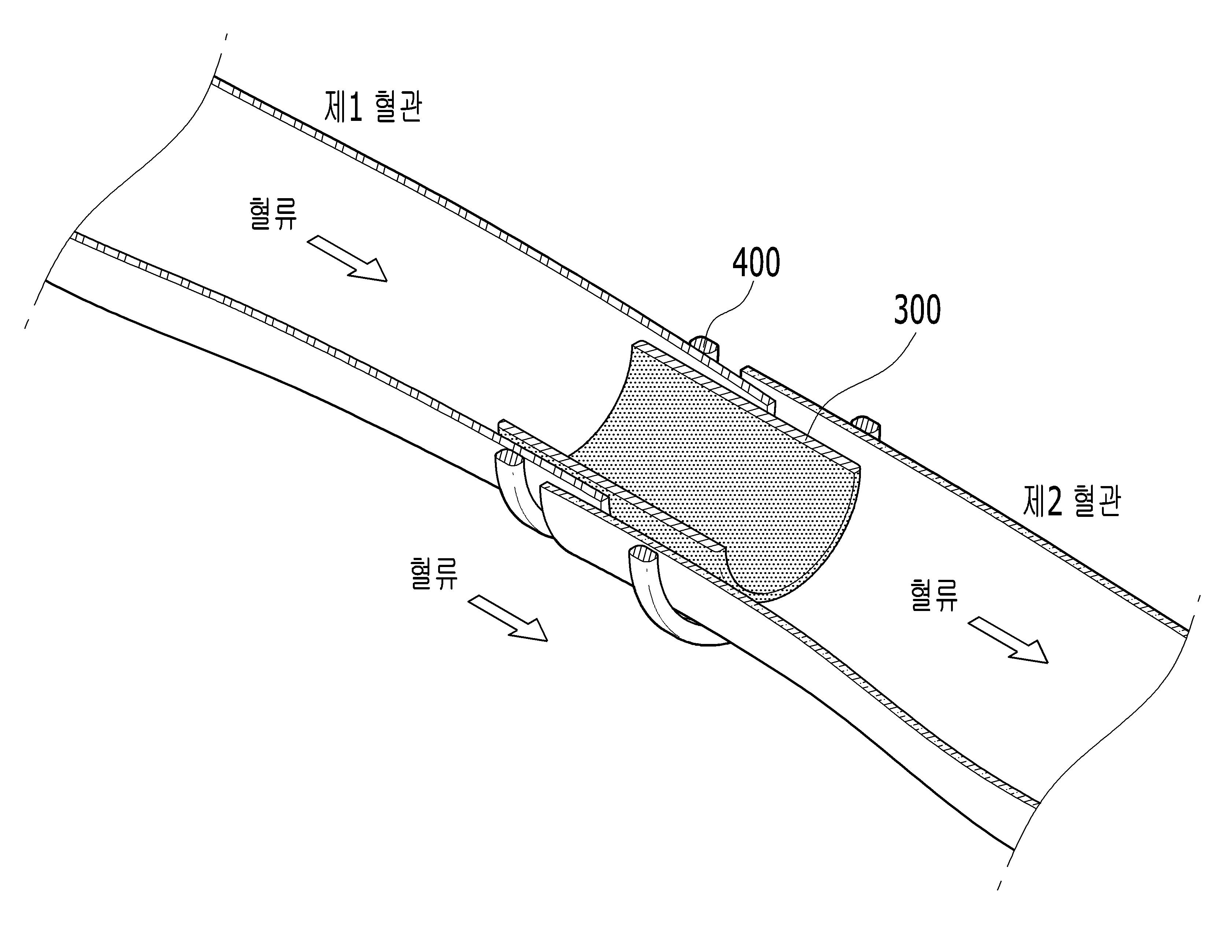 스텐트 구조물을 구비한 혈관 문합기 대표 이미지