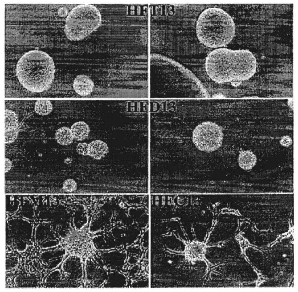 ＳＭＡＣ을 분비하는 인간 신경줄기세포, 이의 제조방법 및용도 대표 이미지