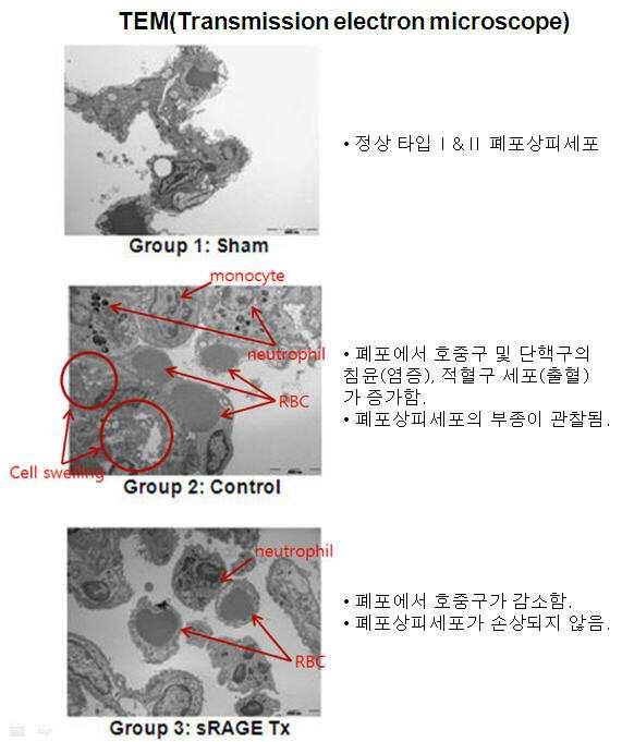 용해성 ＲＡＧＥ를 유효성분으로 포함하는 급성 폐 손상 또는 급성 호흡부전 증후군의 예방 또는 치료용 약제학적 조성물 대표 이미지