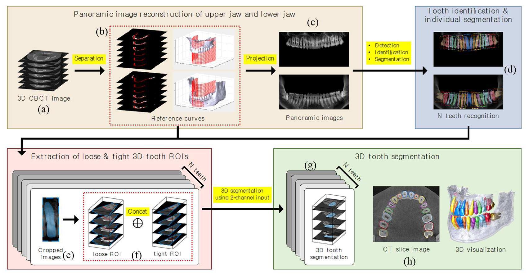 치과용 CBCT에서 개별 치아 자동 식별 분할 장치 및 방법 대표 이미지