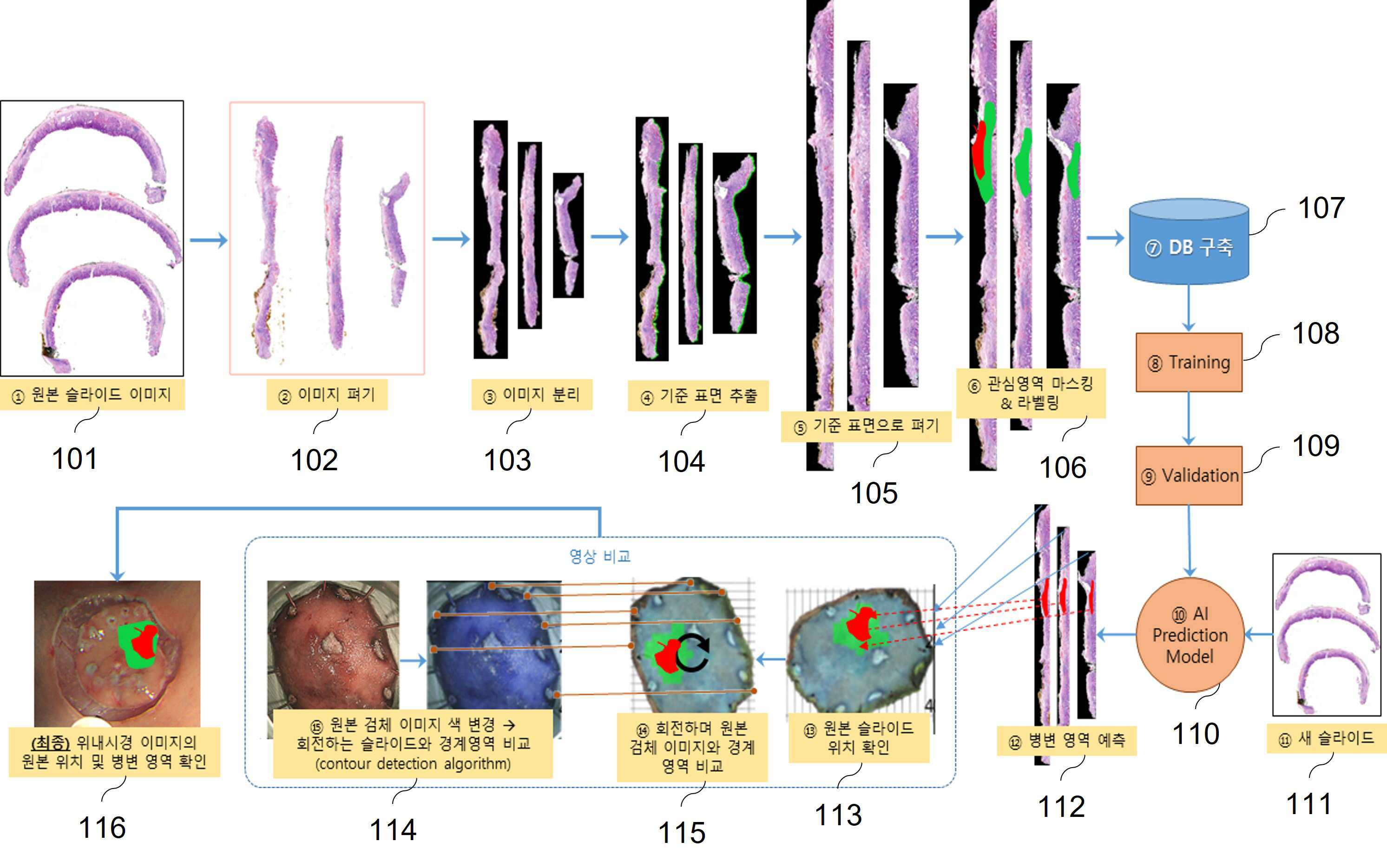 내시경 점막하 박리 검체의 조직구축 병리검사에 대한 인공지능 기반 관리 방법 및 장치 대표 이미지