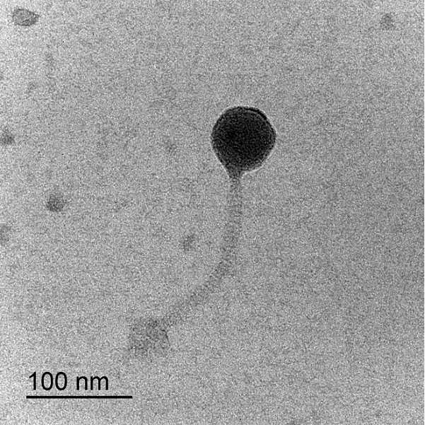 항생제 내성을 갖는 클렙시엘라(Klebsiella)속 균을 용균하는 박테리오파지 대표 이미지
