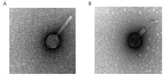 대장균 또는 시겔라속 균에 특이적 사멸능을 갖는 박테리오파지 및 이의 용도 대표 이미지