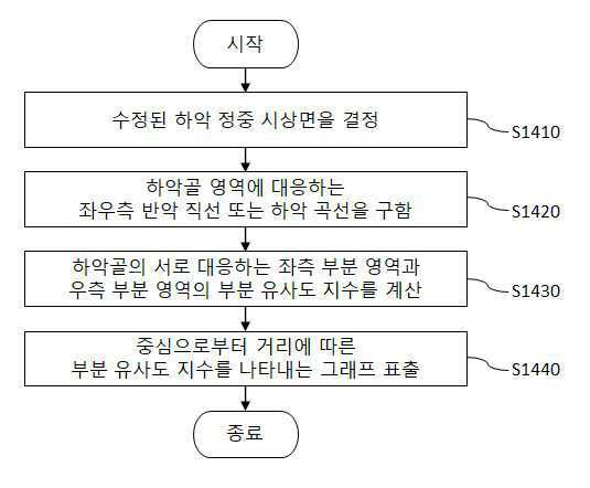 컴퓨팅 장치를 이용한 하악골 비대칭 평가 방법 및 이를 이용한 수술 시뮬레이션 방법 대표 이미지