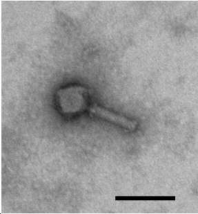 항생제 내성을 갖는 아시네토박터 속의 균을 용균하는 신규한 박테리오파지 대표 이미지