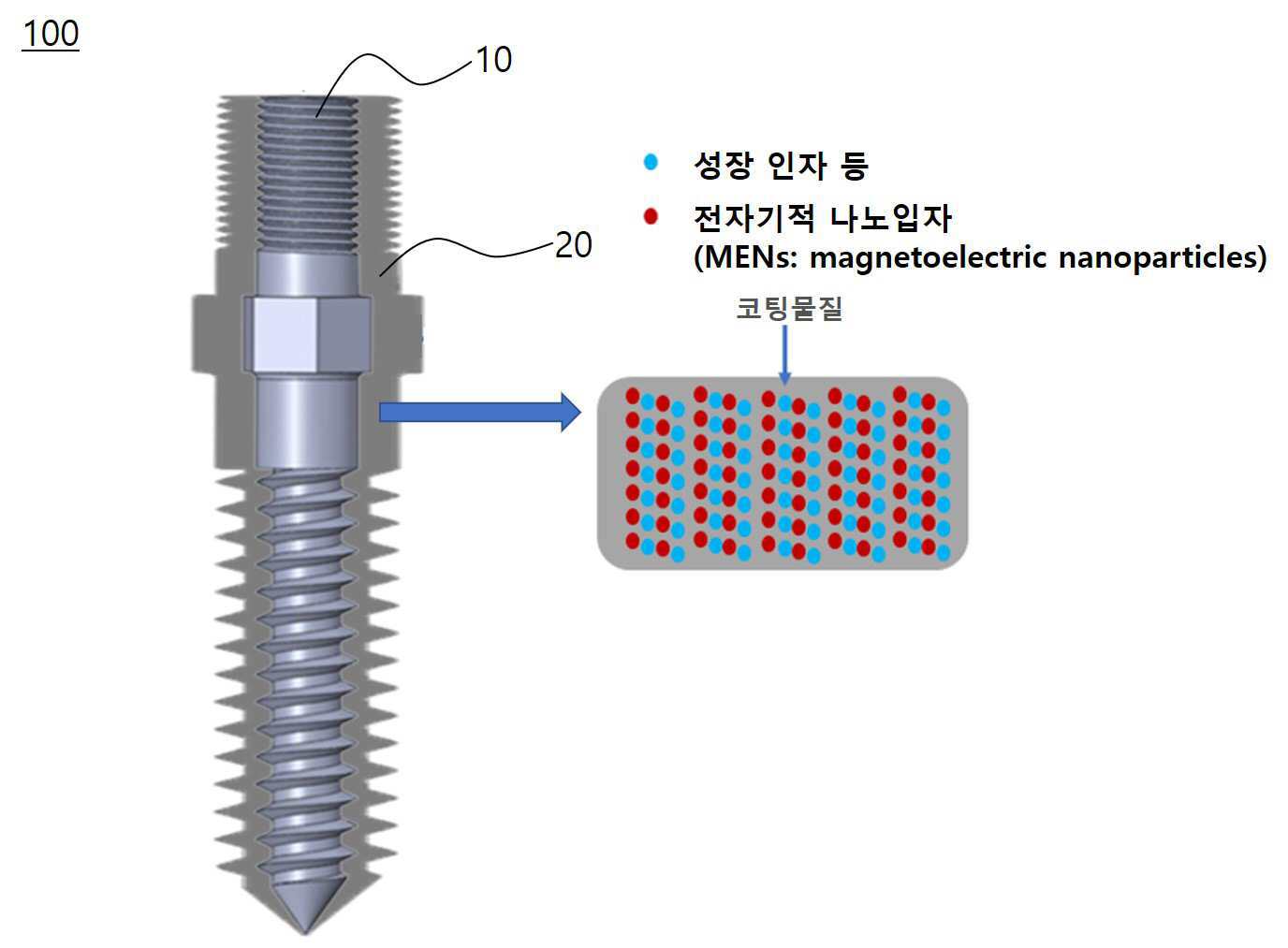 전자기 나노입자를 포함하는 척추 임플란트 및 이의 전자기 구동 시스템 대표 이미지