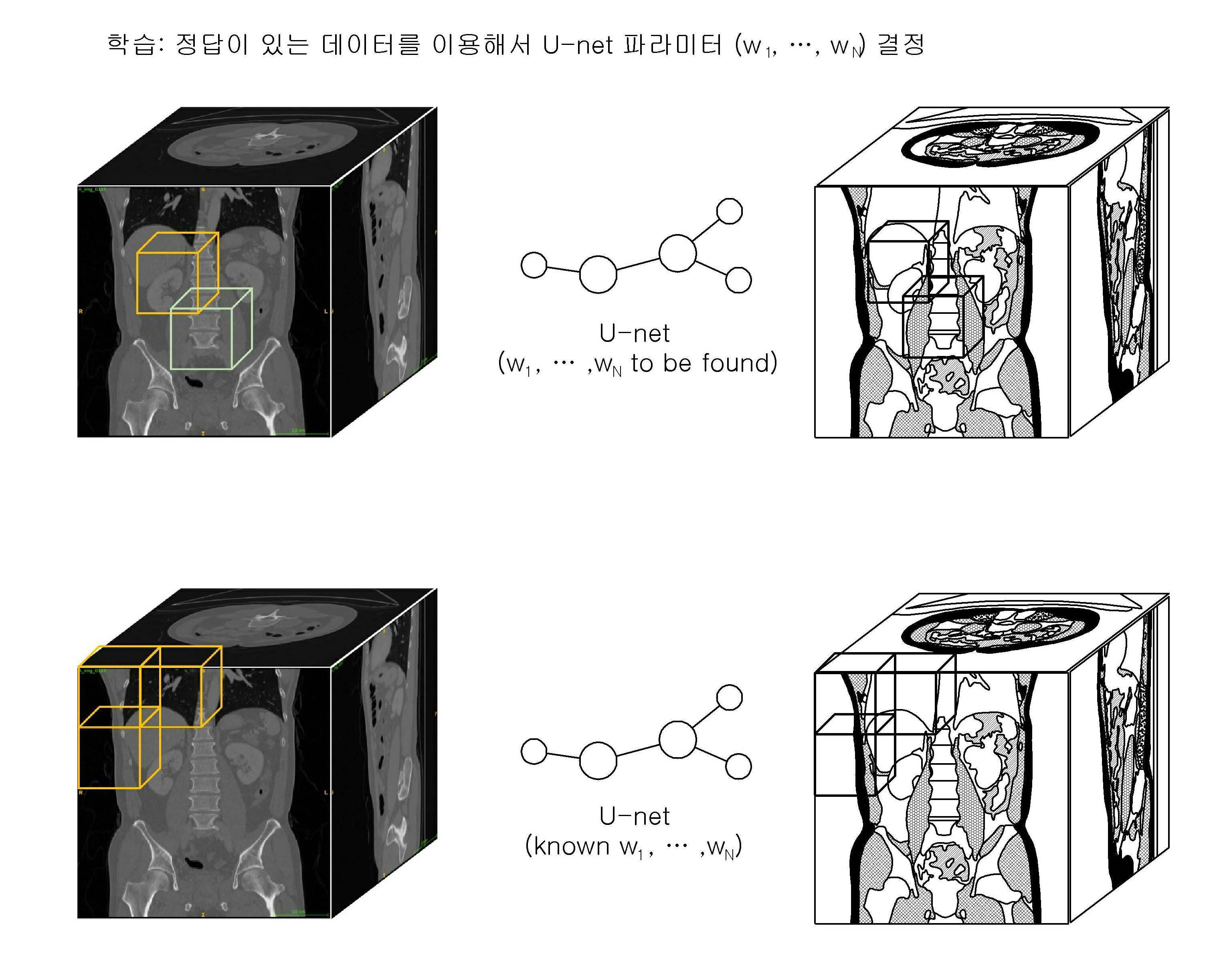 의료 영상을 기초로 딥러닝 알고리즘을 이용하여 인체 성분을 분석하기 위한 방법 및 장치 대표 이미지