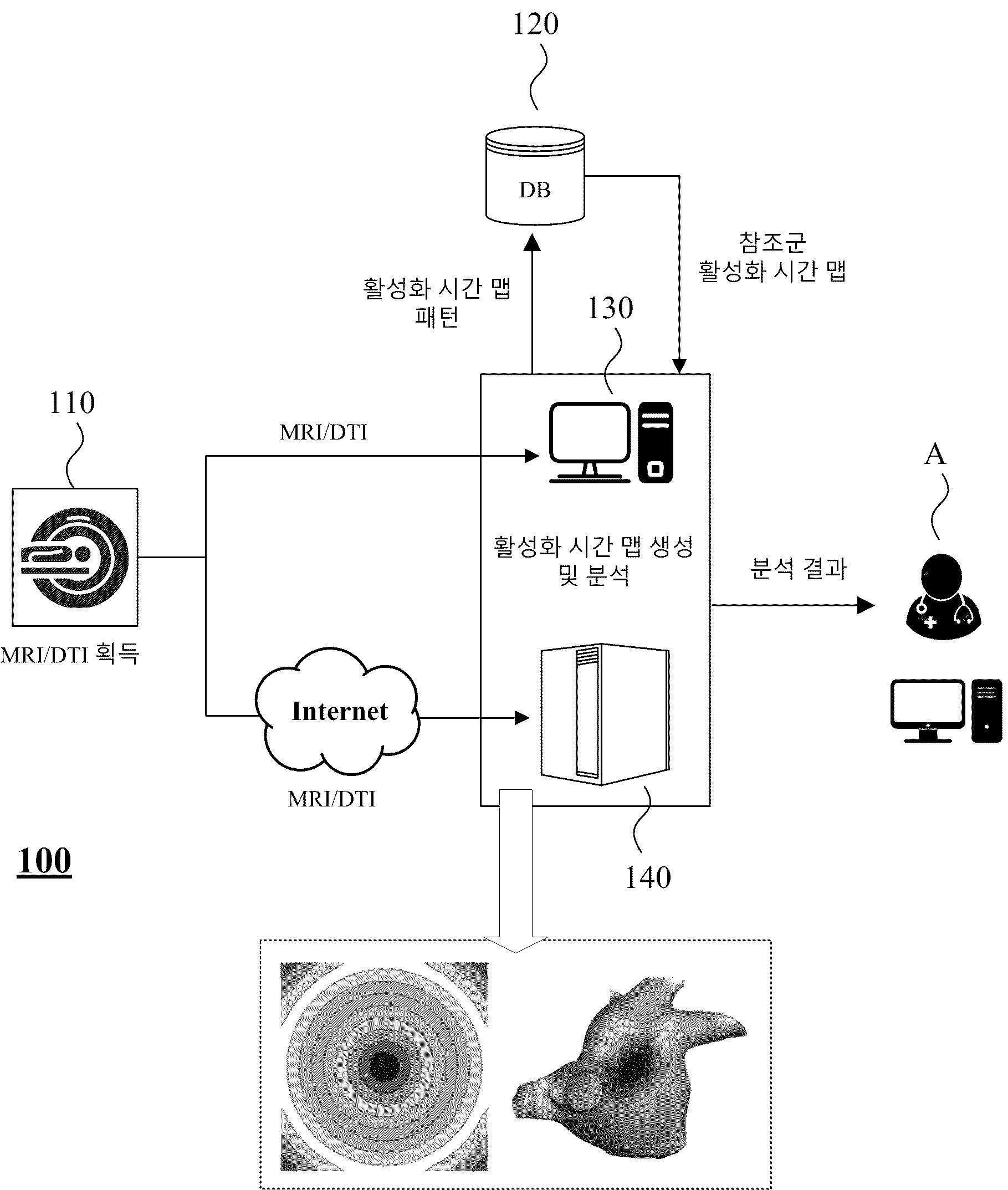 활성화 시간 맵을 생성하는 분석 장치 및 활성화 시간 맵을 이용한 대상자 평가 방법 대표 이미지