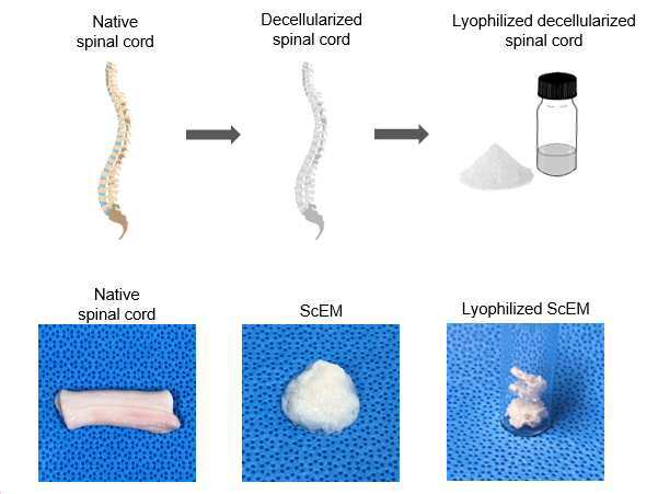 탈세포 척수 조직 유래 세포외기질 및 이를 포함하는 조성물 대표 이미지